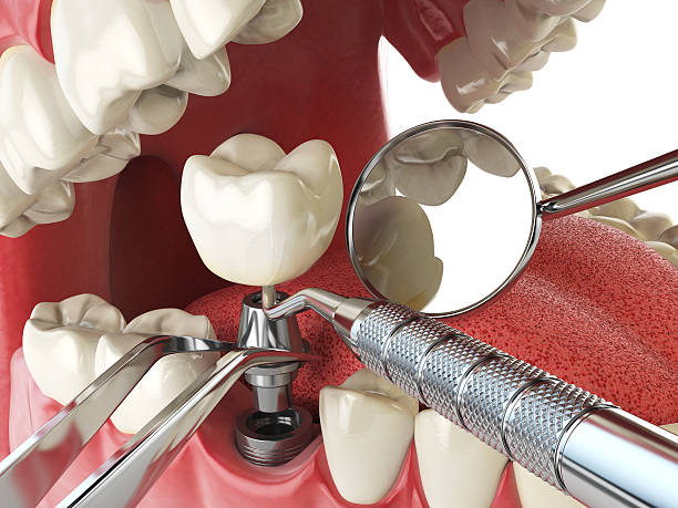 Best Emergency Broken Tooth Repair in Bryn Mawr Skyy, WA
